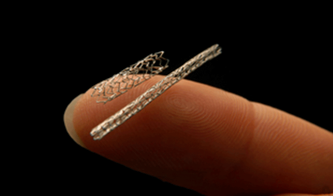 STENT