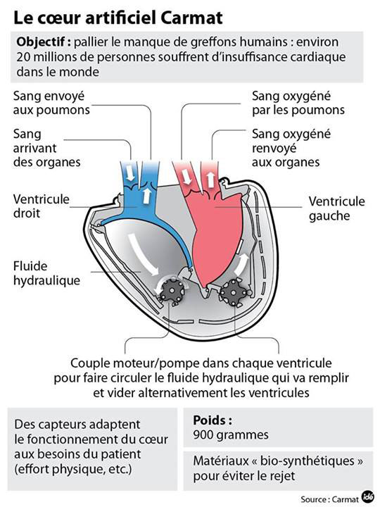 coeur-artificiel-france-2013